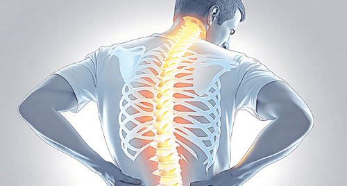 Spinal Cord Disorders